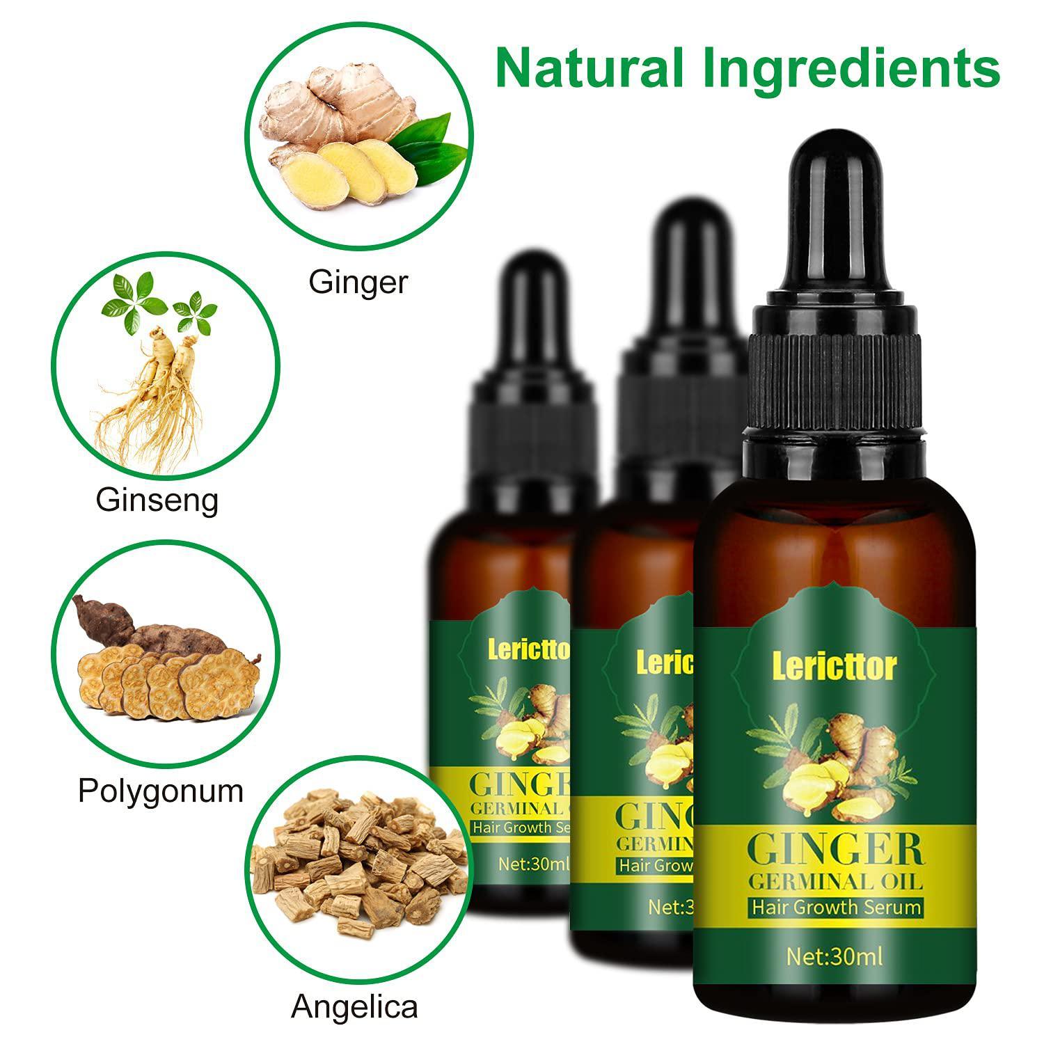 Ginger Germinal Oil, Ginger Hair Growth Oils, 30ML(3Pack) - Etyn Online {{ product_tag }}